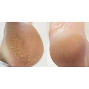 Крем для ніг та рук від тріщин  Nails Of The Day 30 мл, фото 3