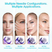 Картридж для микронидлинга Mast Microneedle 0.30 42P (1 шт), фото 5